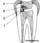 Pulp devitalization